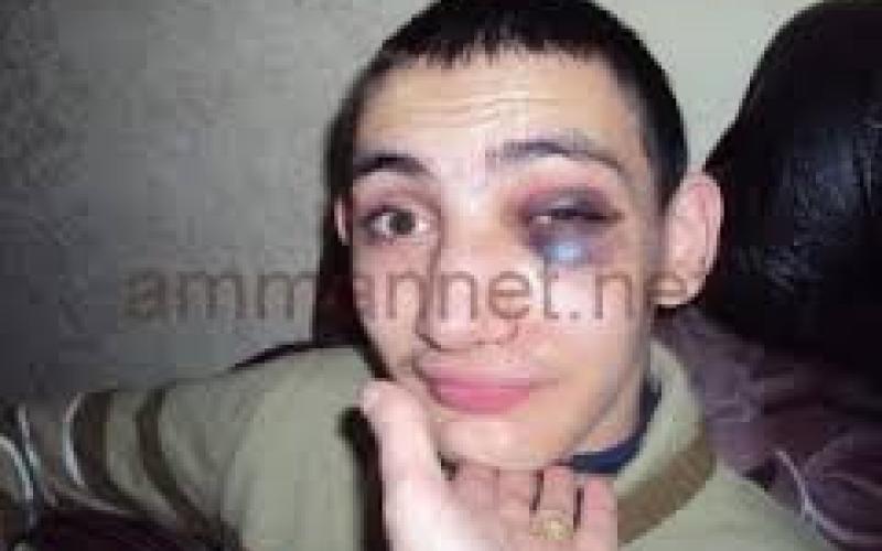 اغلاق 7 مراكز لرعاية المعوقين وانذار 16 مركزا