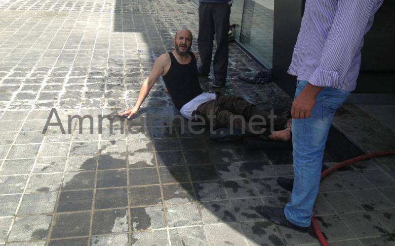 سوري يقدم على حرق قدميه