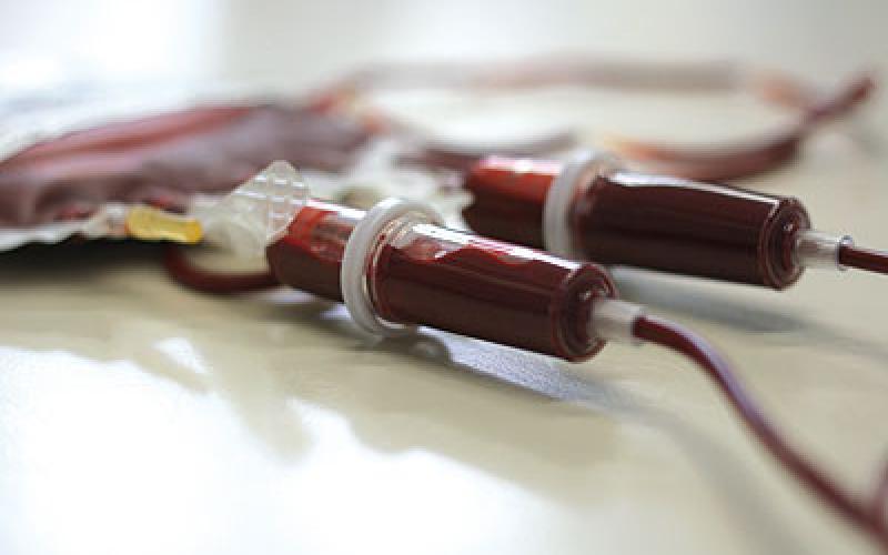 فحوصات ما قبل الزواج تخفض اصابات الثلاسيميا إلى النصف