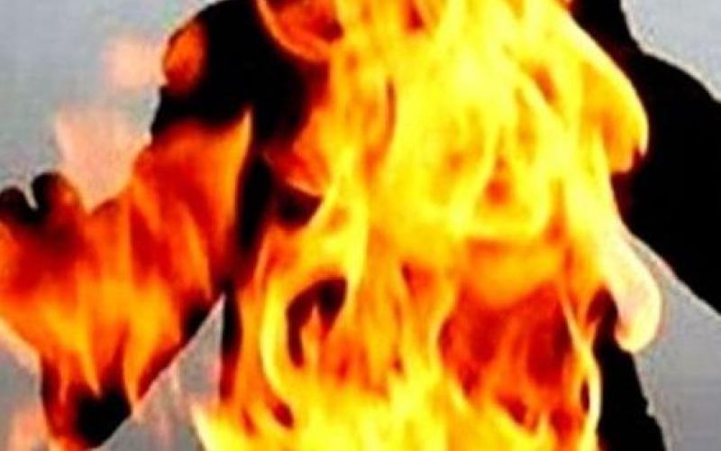 وفاة مواطن أضرم النار بجسده في الزرقاء