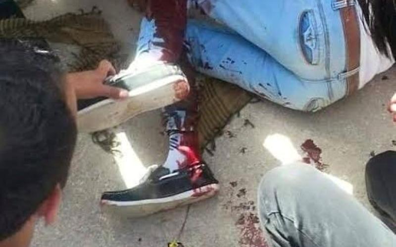 تجمهر في آل البيت بعد إصابة طالب بعيارات نارية