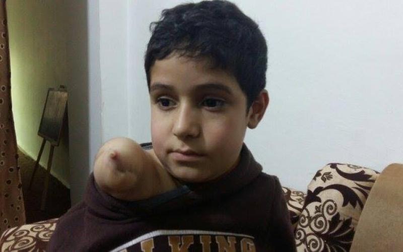 عمار.. الطفل السوري الذي سقط من ذاكرة  الحرب