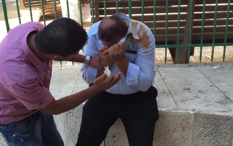 إصابات بصفوف حرّاس الأقصى أثناء تصديهم لاقتحامات متطرفين يهود