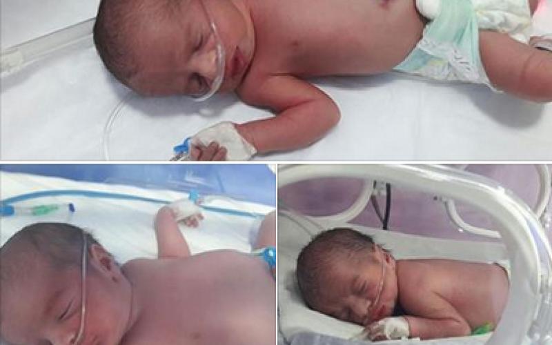 عملية ولادة نادرة لـ 3 توائم بـ"قيصرية" في مستشفى المقاصد (صور)‎