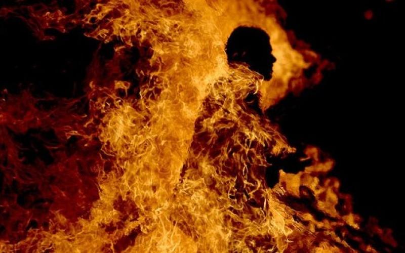 توضيح من بلدية اربد الكبرى حول حرق أحد موظفيها نفسه