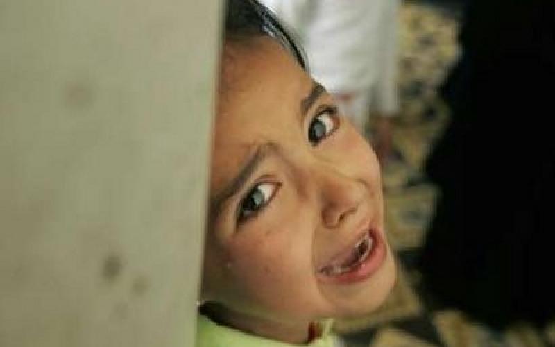 نقابة الأطباء تعيد الوفد الطبي من غزة