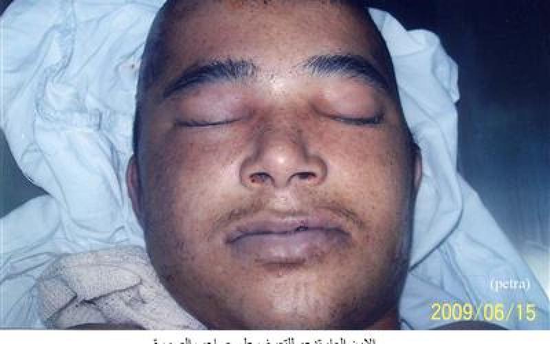 توفي منذ ايام ولم يسأل عنه احد