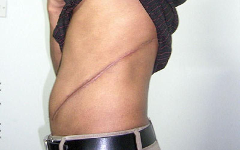 شباب صيد ثمين لسماسرة الأعضاء البشرية