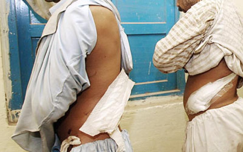 توقيف سمسار كلى وشابين تبرعا بكلاهم مقابل المال