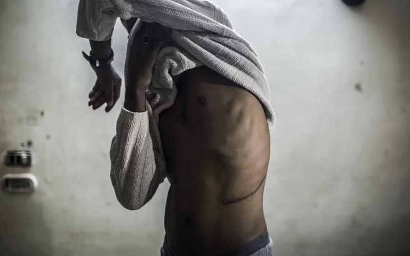 Archive: A Sudanese man testified that he sold his kidney to organ traffickers in 2017.